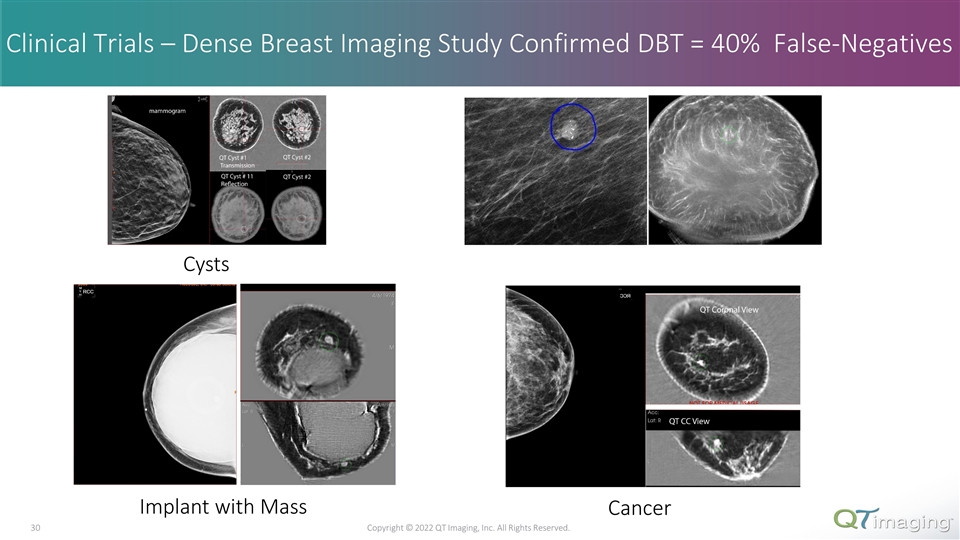 Slide 30