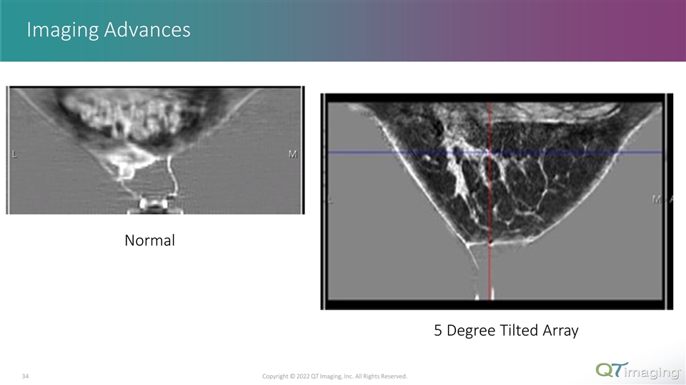Slide 34