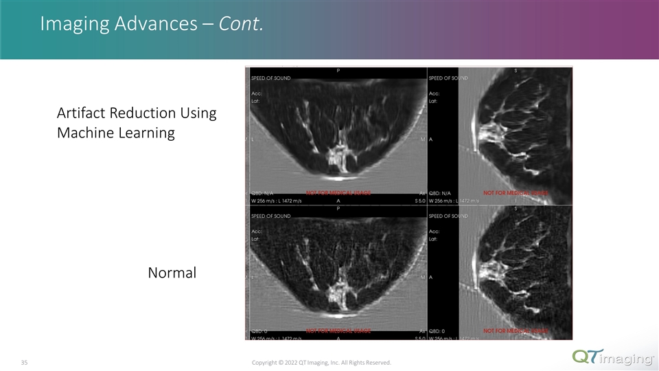 Slide 35