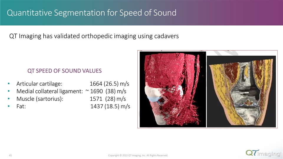 Slide 45