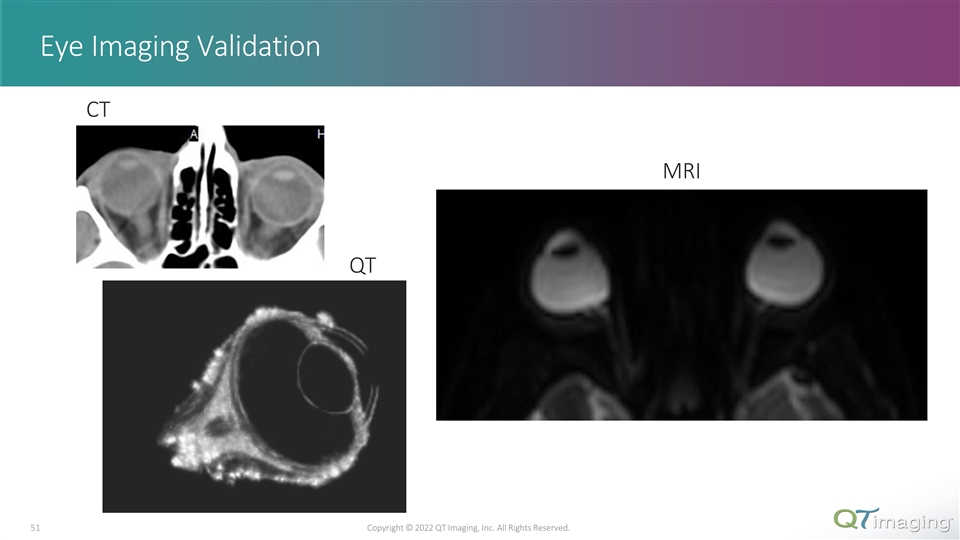 Slide 51