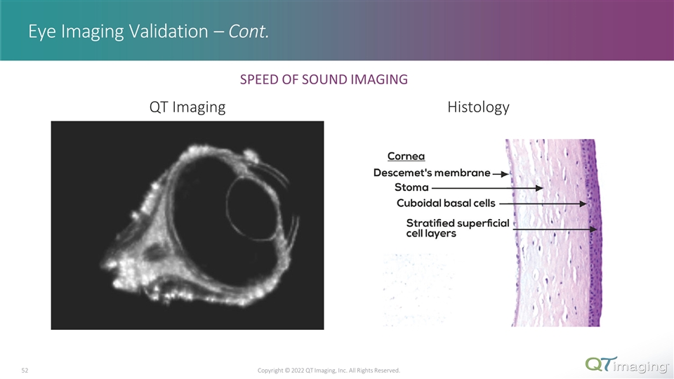 Slide 52